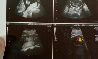 B超市小孩能进吗